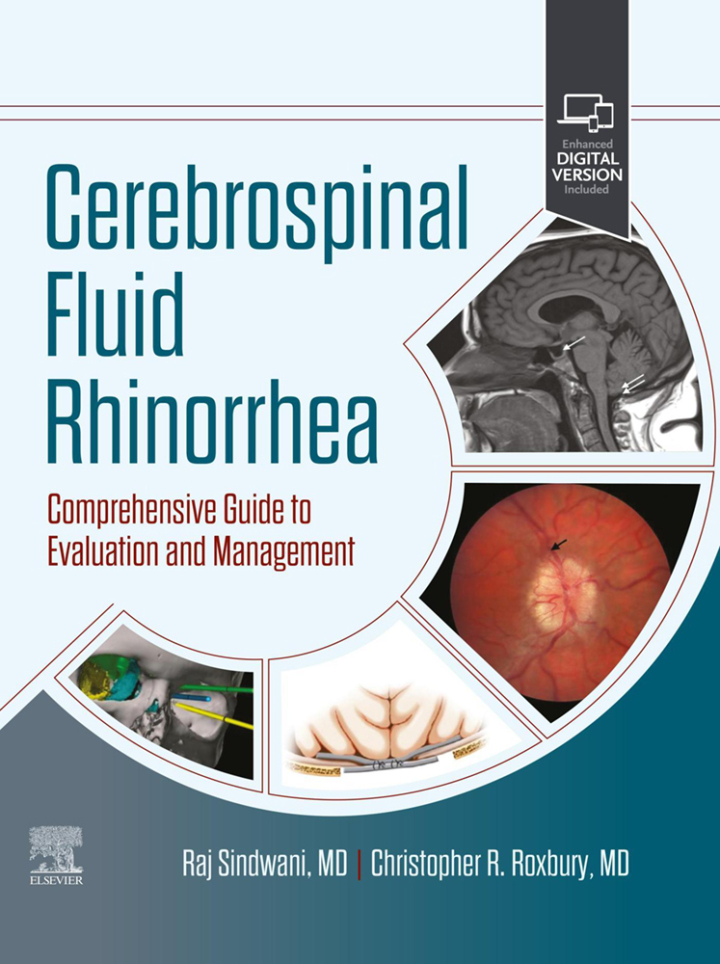 Cerebrospinal Fluid Rhinorrhea: Comprehensive Guide to Evaluation and Management