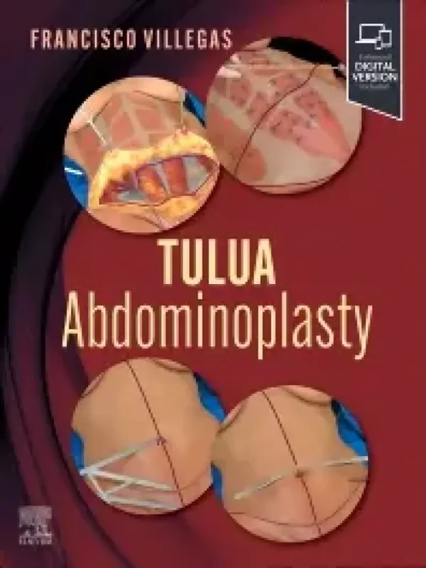 TULUA Abdominoplasty: Transverse Plication Technique