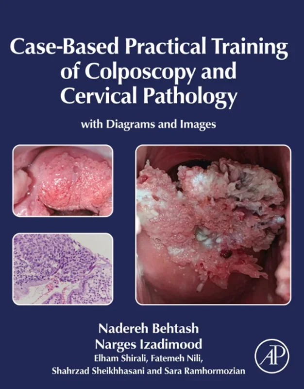Case-Based Practical Training of Colposcopy and Cervical Pathology: With Diagrams and Images