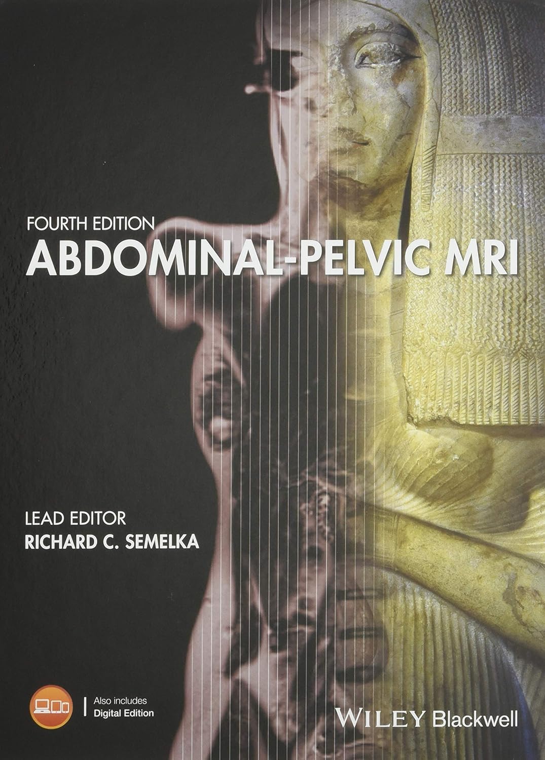 Abdominal-Pelvic MRI 4th Edition