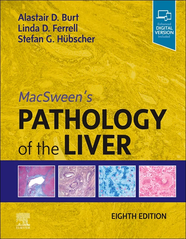 MacSween's Pathology of the Liver 8th Edition